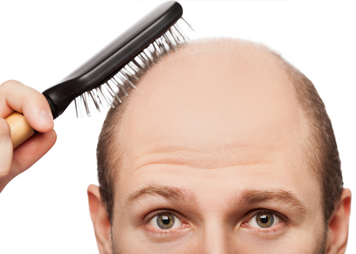 سیستم ایمنی ضعیف از دلایل ریزش مو در مردان
