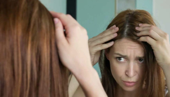 حساسیت پوست سر به مواد گراتیه یکی از عوامل ریزش مو بعد از کراتینه