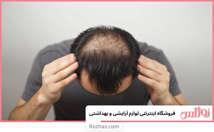 علت ریزش موی سر چیست؟